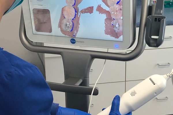 3D iTero Scanner - Kenneth Myers DDS